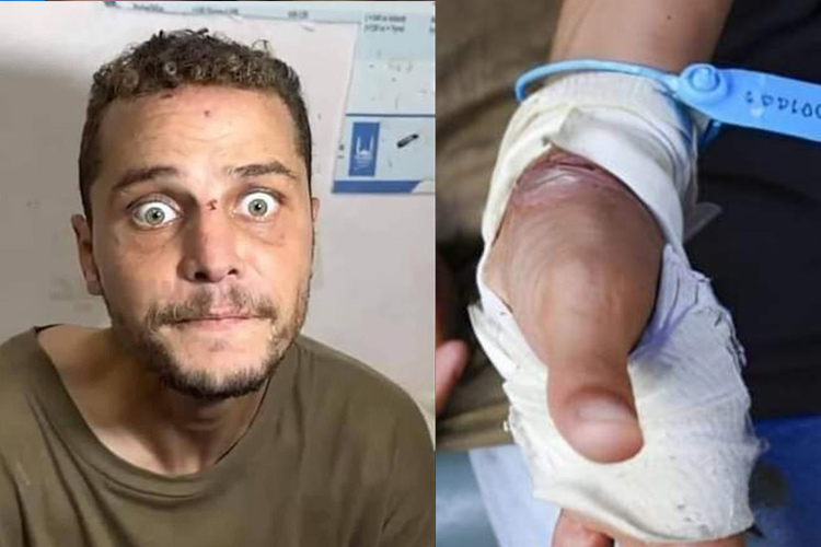 Traumatised Gazan shows signs of torture, disorientation after being held Traumatised Gazan shows signs of torture, disorientation after being held in Israeli prison for a month
