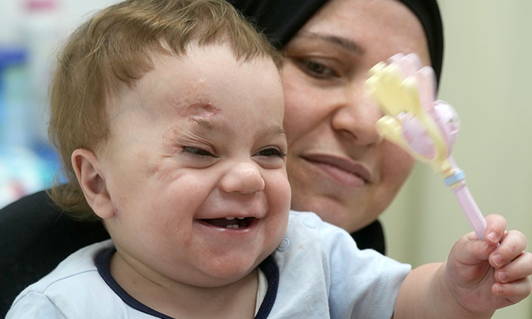 A baby evacuated from Gaza lost an eye and most A baby evacuated from Gaza lost an eye and most of his family in the war