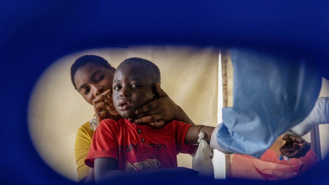 Congo says it will receive its first mpox vaccines next week to address new global emergency