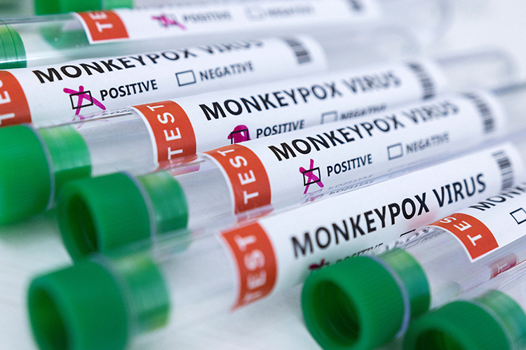 UAE dispatches vaccines to 5 African nations to combat outbreak UAE dispatches vaccines to 5 African nations to combat outbreak of Monkeypox